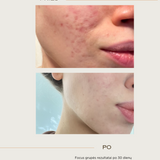 Clearing Skin Wash prausiklis su probiotikais ir pieno rūgštimi