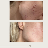 Clearing Skin Wash prausiklis su probiotikais ir pieno rūgštimi